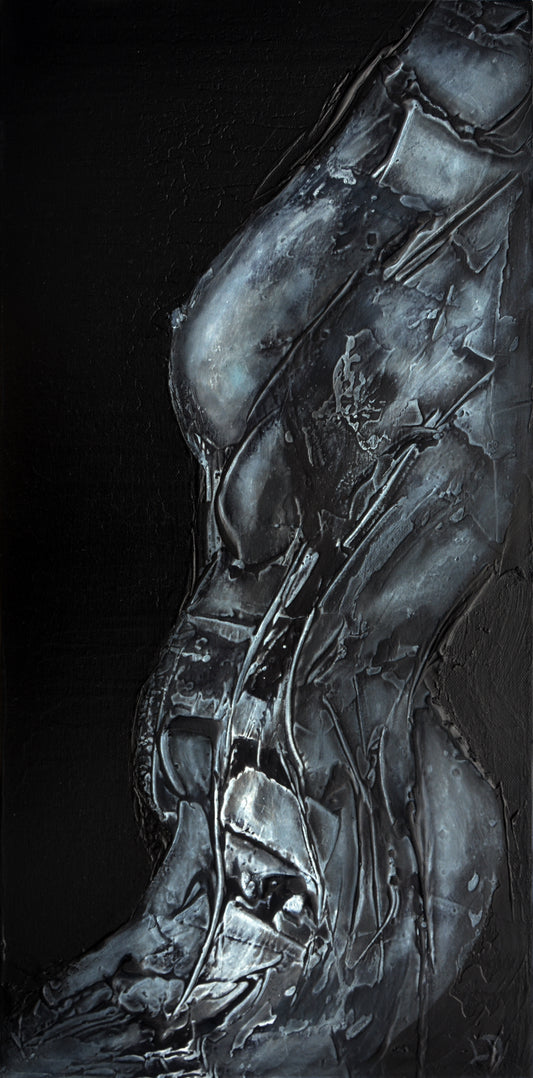Xray of a Woman